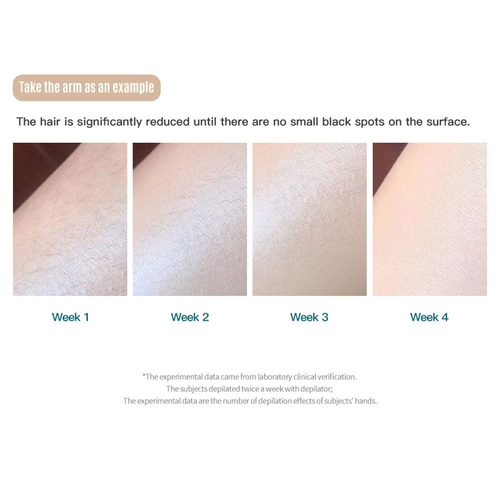 Permanent Hair Removal Unlimited Flash Lifetime Use Unlimited flash times Sapphire ice-cooling feature Skin rejuvenation + hair removal function Adjustable 5 intensity levels White in stock  1 years Official Warranty
